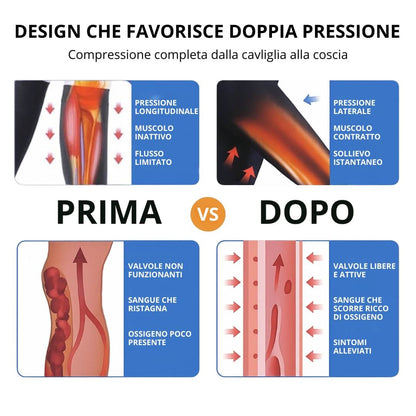 Calze a Compressione Intere Grado II