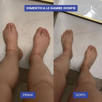 Calze a Compressione Nursiv